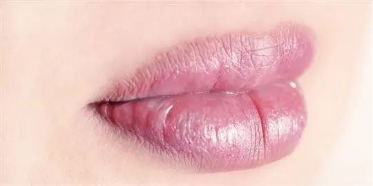 Candy lipz za povećanje usana